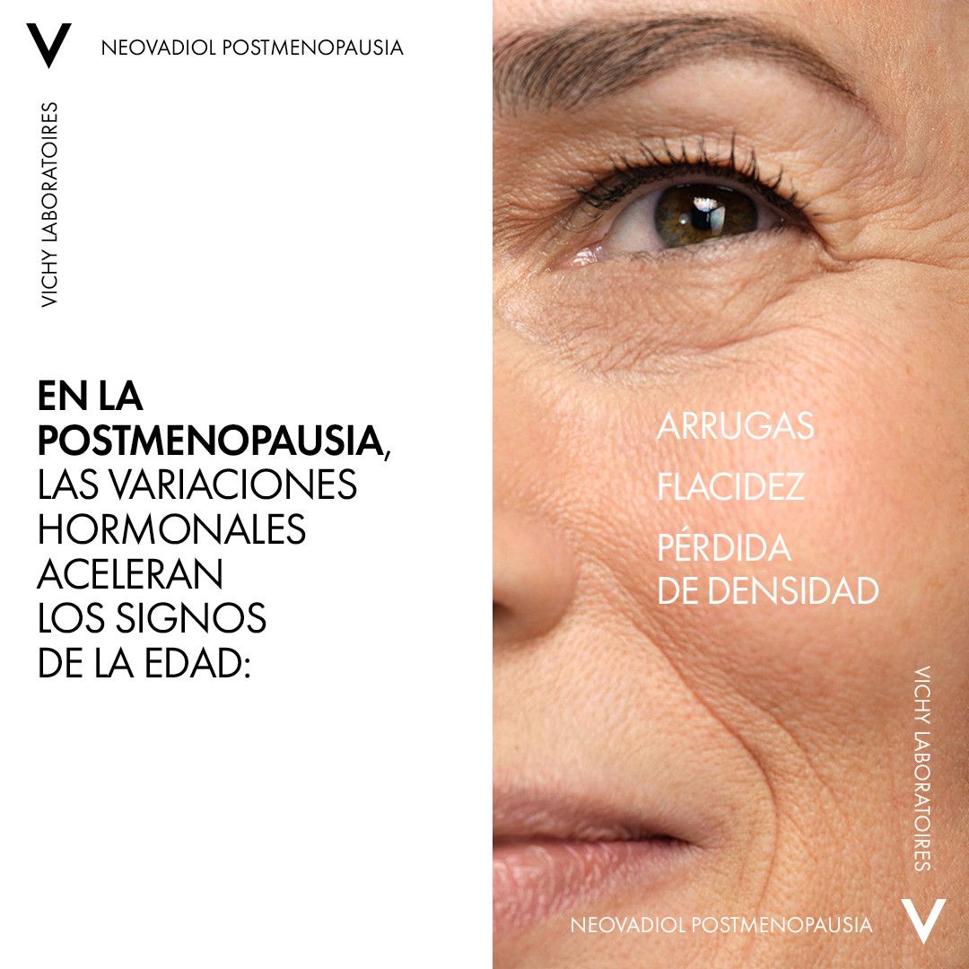 Neovadiol pēcmenopauzes dienas krēms pret sejas noslīdēšanu Sejas kosmētika no aptiekas