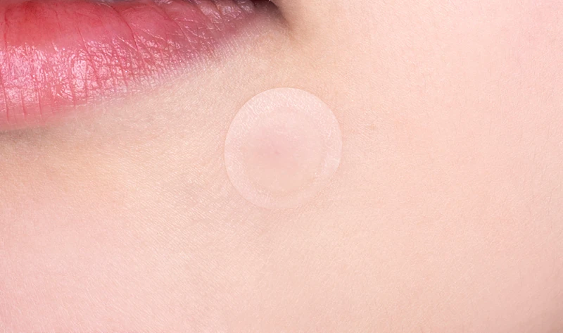 Náplasti VT Cosmetics Cica Spot Patch pre problematickú pleť