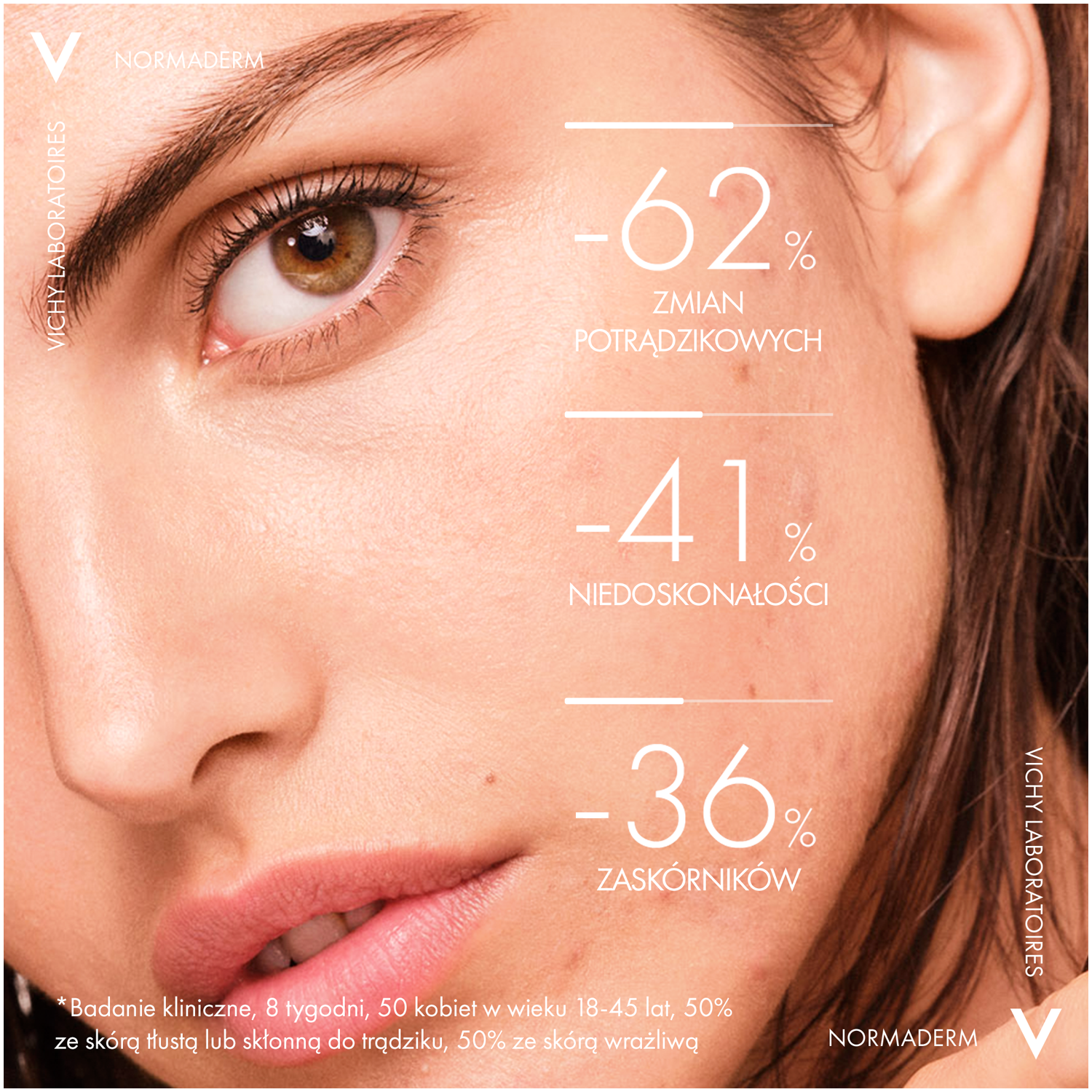 Vichy Normaderm Fitosolucija