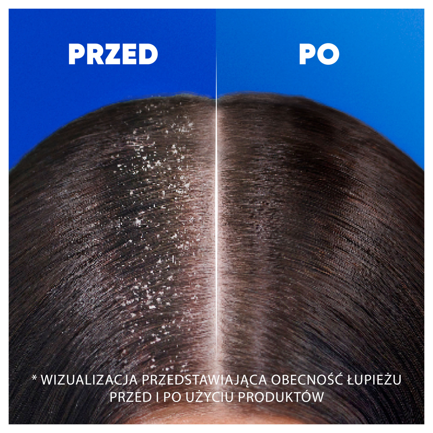 Head Shoulders Hårschampo 400ml Extra volym