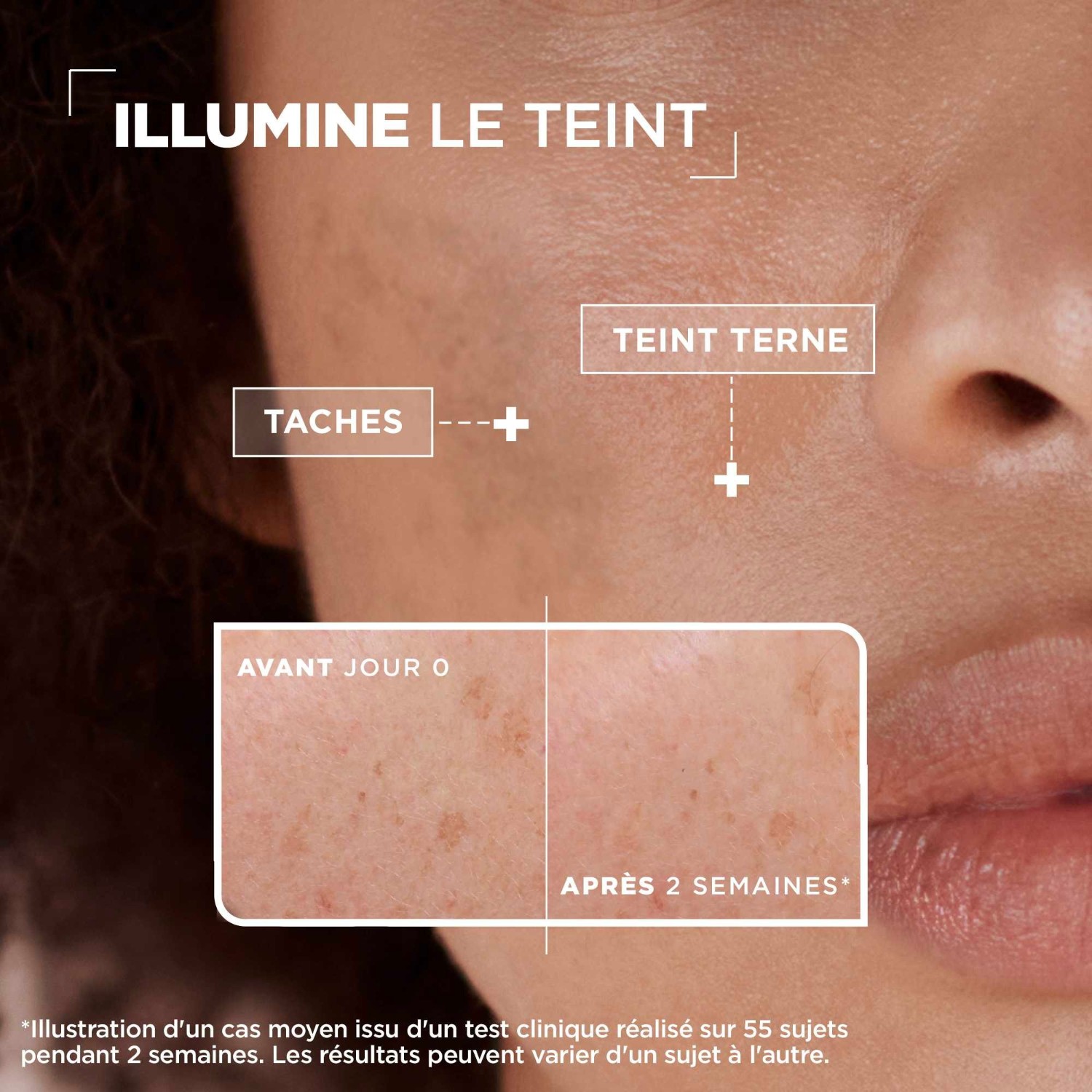Mixa Sérum Concentré Anti-tache