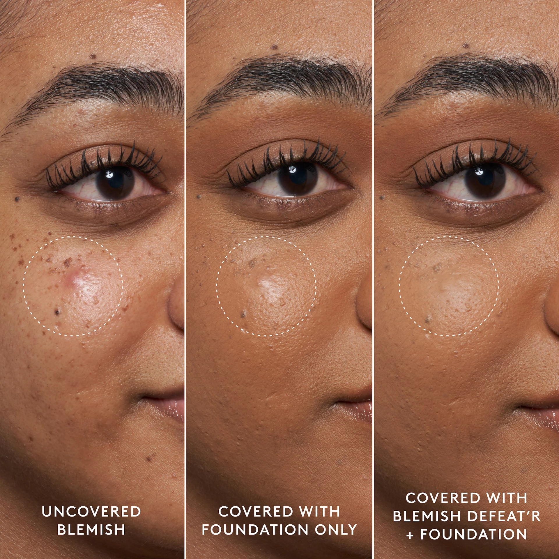 Blemish Defeat'r BHA gel za ciljano uklanjanje akni 15 ml - Fenty Skin