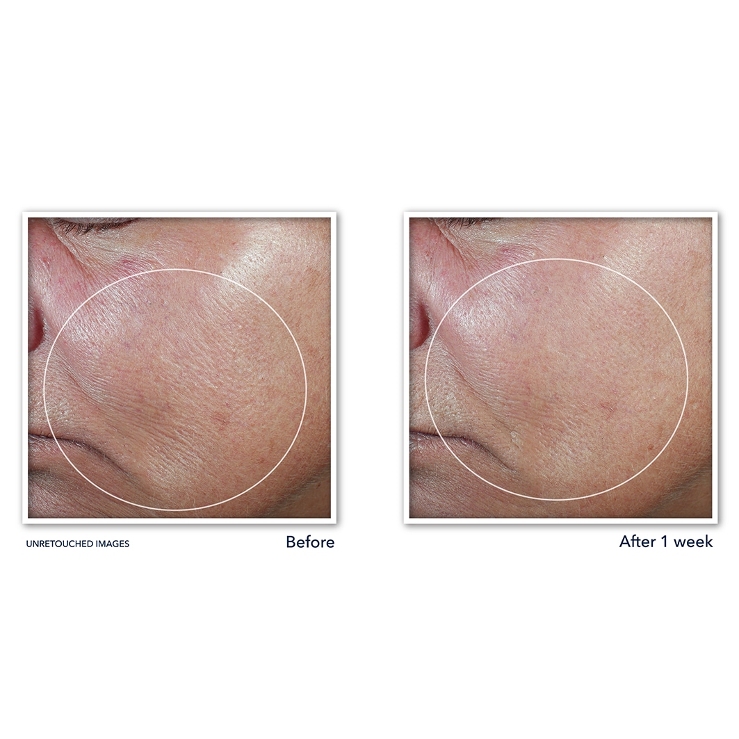RoC Anti-Aging Serum Derm Correxion Stretching Serum Stick - 30 g