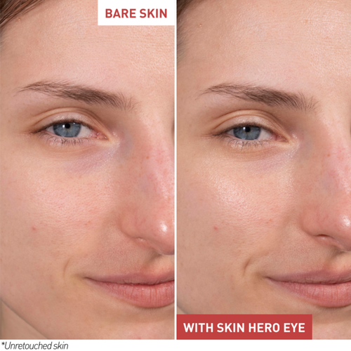 Skin Hero Eye