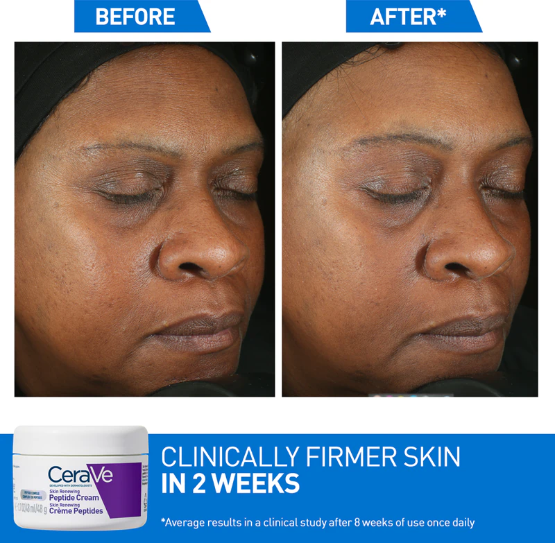 Regeneračný nočný krém CeraVe Skin Renewing Peptide Night Cream, ktorý obnovuje hustotu pleti