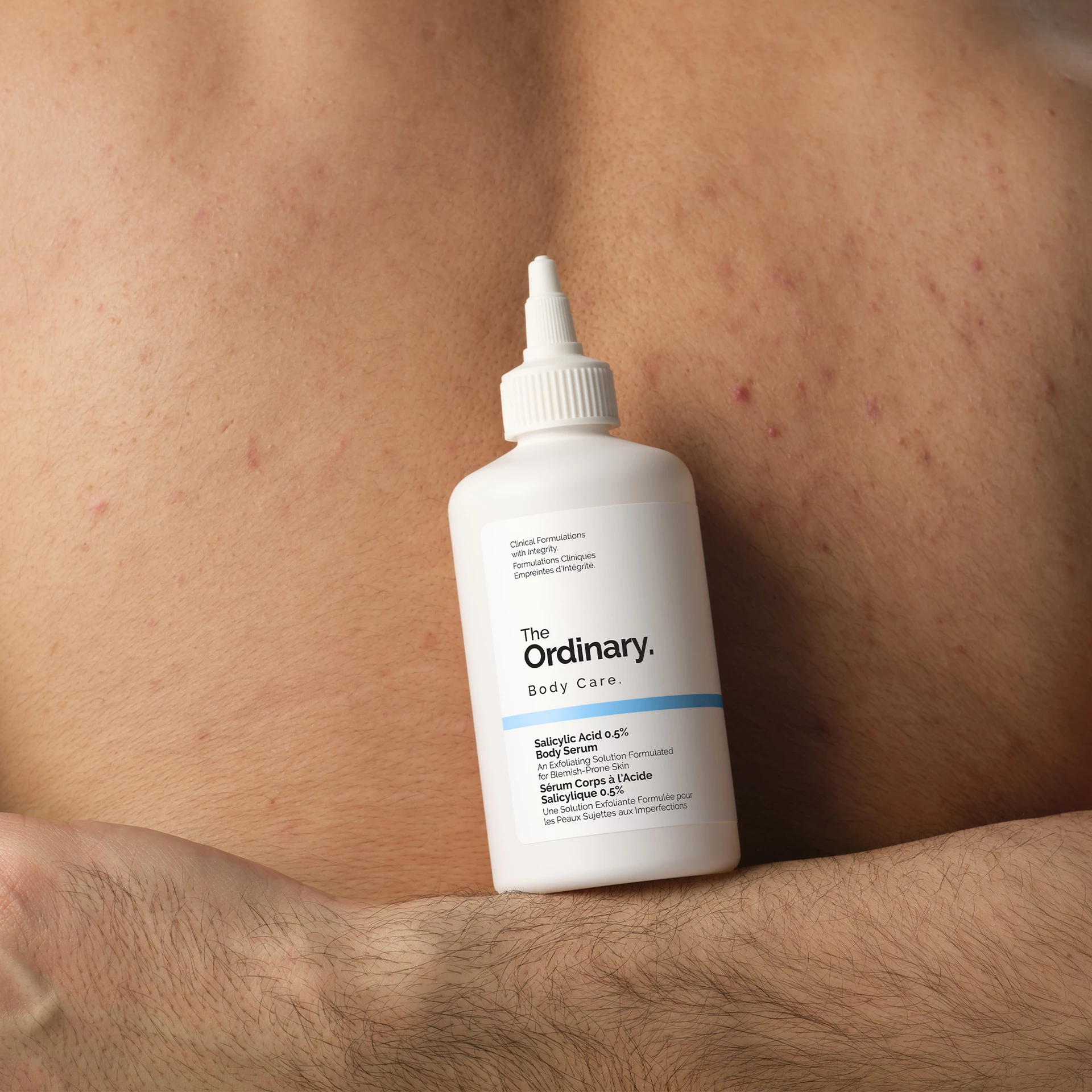 Serum za tijelo sa salicilnom kiselinom 0,5% 240 ml - The Ordinary