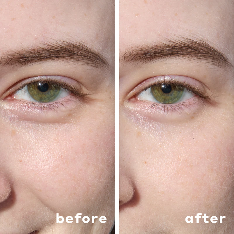 Os adesivos de hidrogel para a área dos olhos Mario Badescu combatem o inchaço e as olheiras.