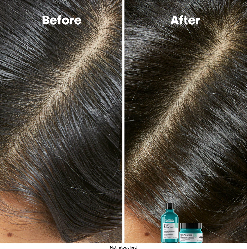 Shampoo de limpeza avançada L'Oréal Professionnel Serie Expert Scalp para couro cabeludo oleoso