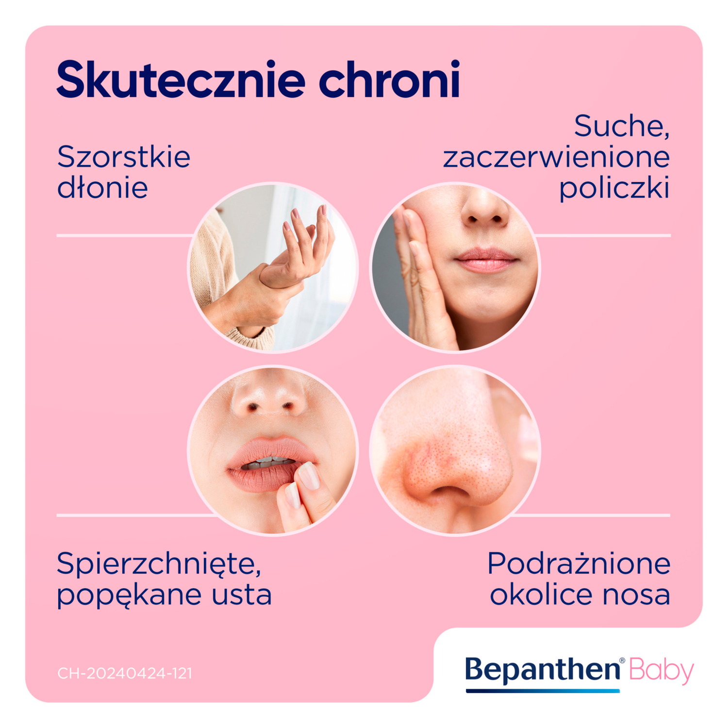 Bepanthen védő kenőcs 30g babáknak