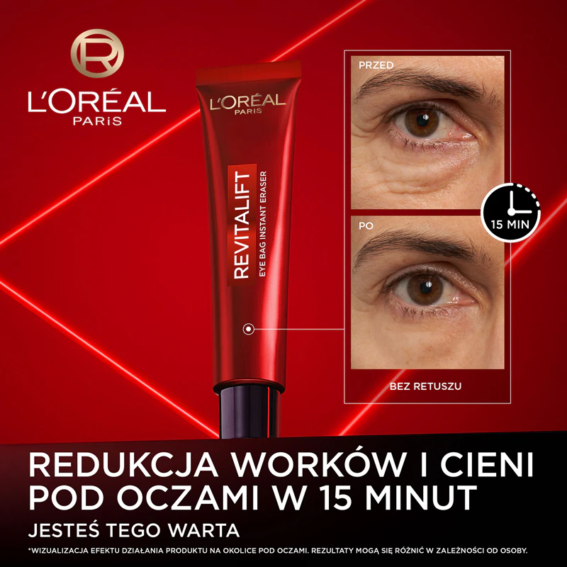 L'Oréal Paris Revitalift Laser Eye Bag Instant Eraser: Vermindert donkere kringen en wallen voor huidverjonging.