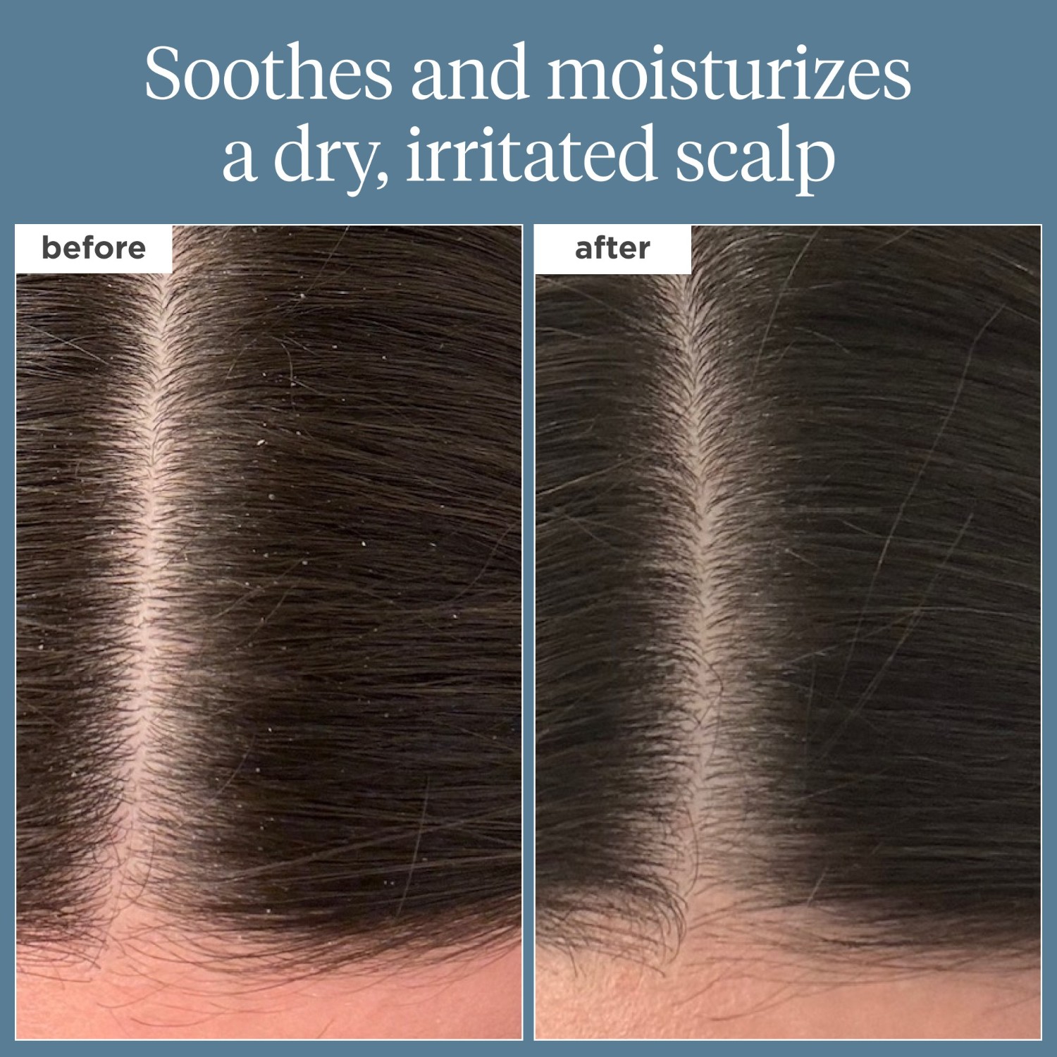 Briogeo Scalp Care Scalp Revival™ Olio pre-lavaggio al rosmarino per capelli e cuoio capelluto – 100 ml