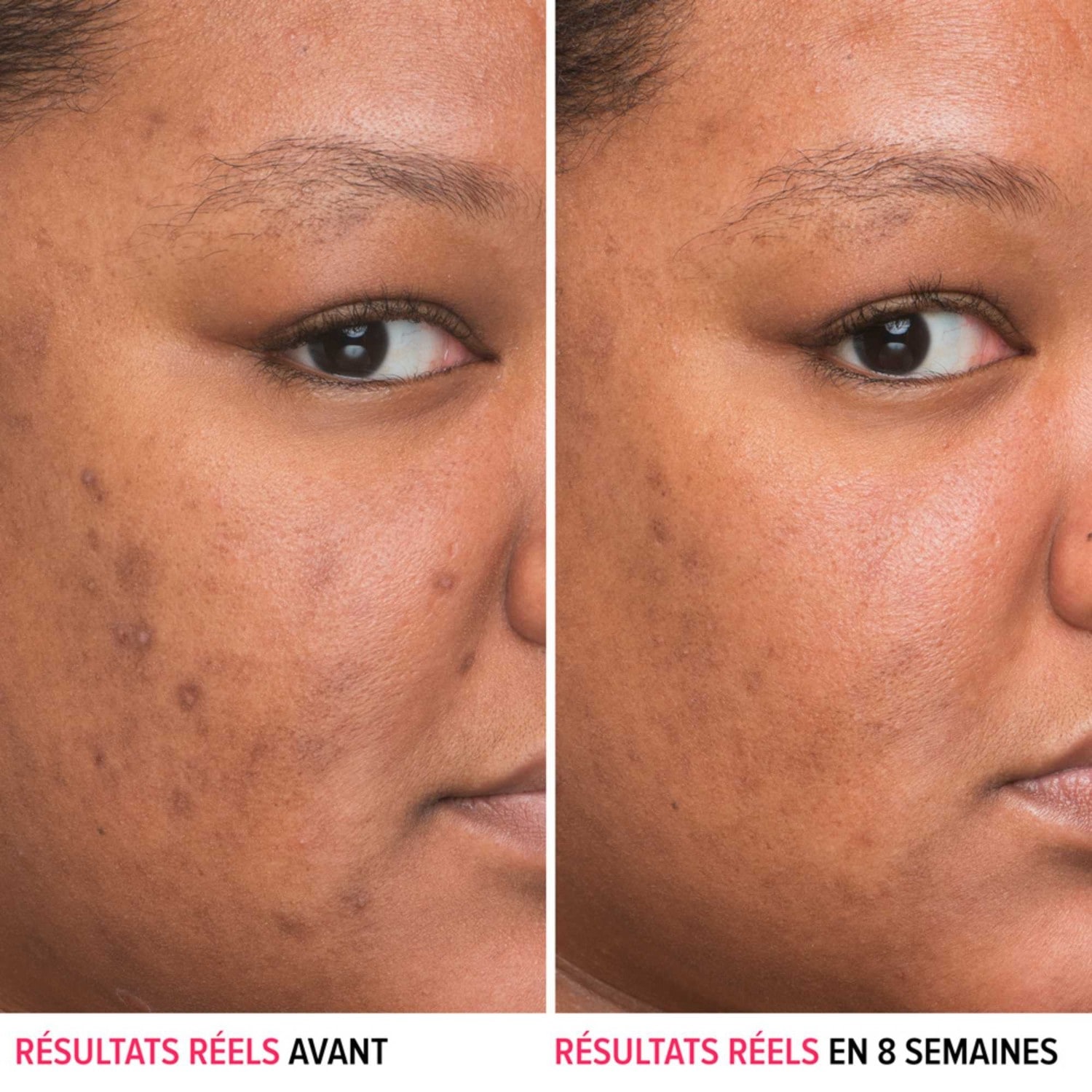IT Cosmetics Sérum anti-taches à la niacinamide
