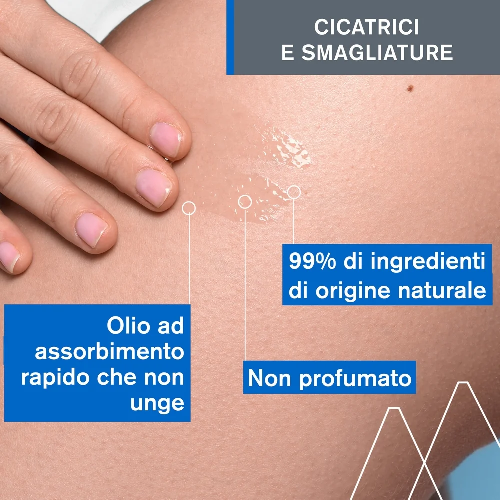 BARIÉDERM Olio Dermatologico - Olio elasticizzante antismagliature