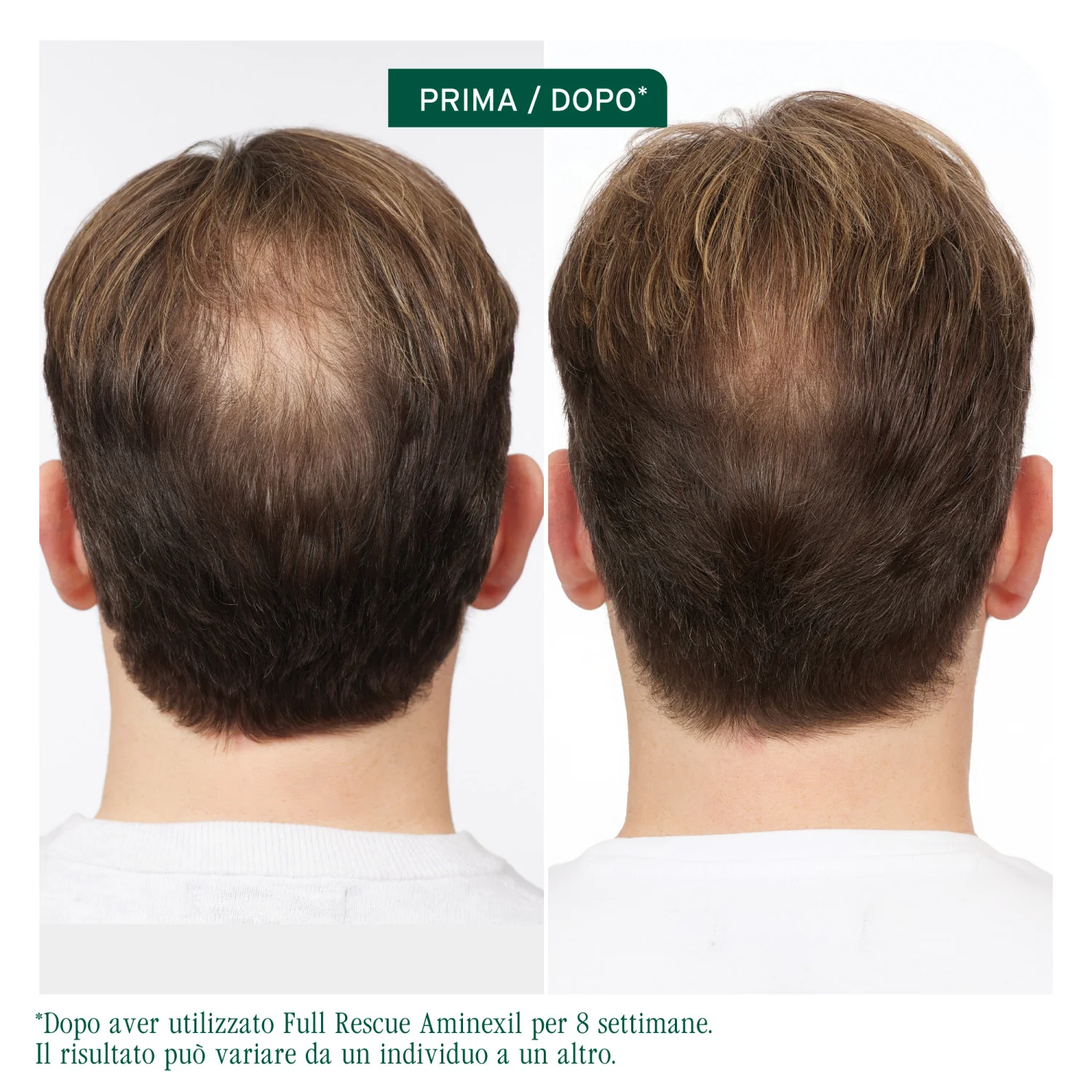 Full Rescue Trattamento Aminexil - Trattamento Anticaduta Capelli