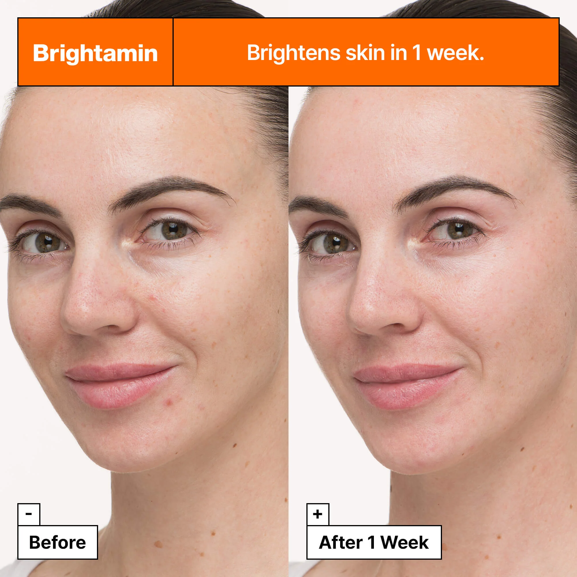 Brightamin Serum Ampoule - Siero viso illuminante