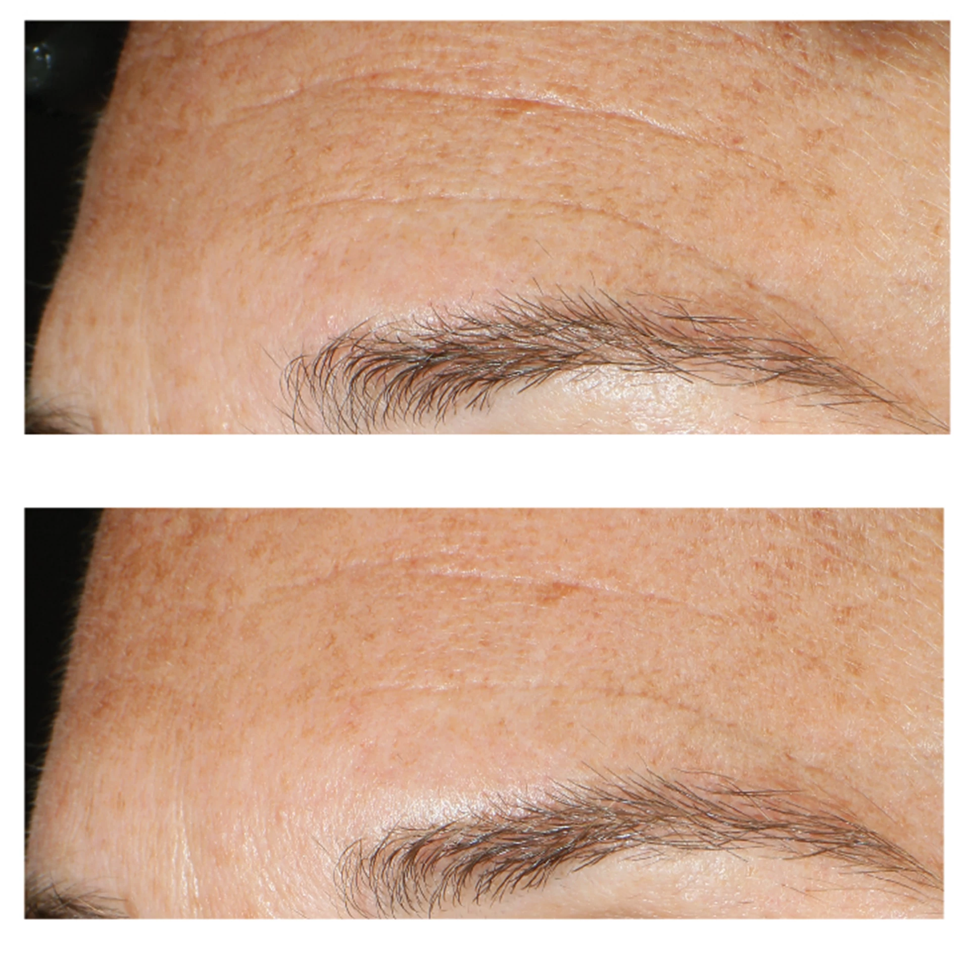 Feltöltő Többsavas Peeling 100 ml - Murad