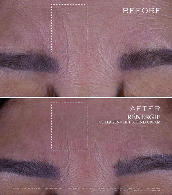 Lancôme Rénergie Collagen+ Lift-Xtend Cream kolageno veido kremas