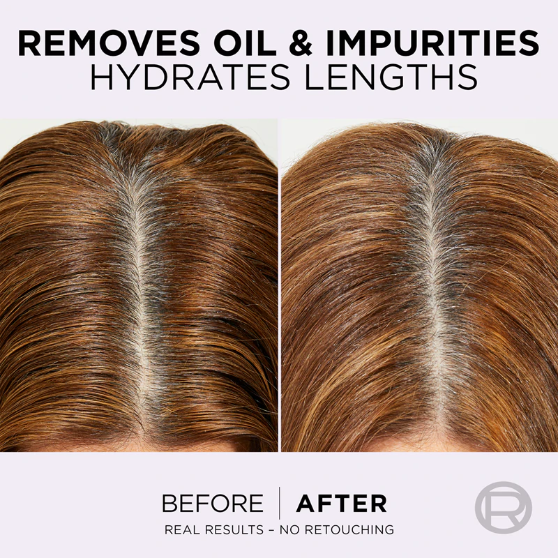 L'Oréal Paris Elseve Hyaluron Pure Hydraterende Shampoo voor een vette hoofdhuid en droge haarpunten