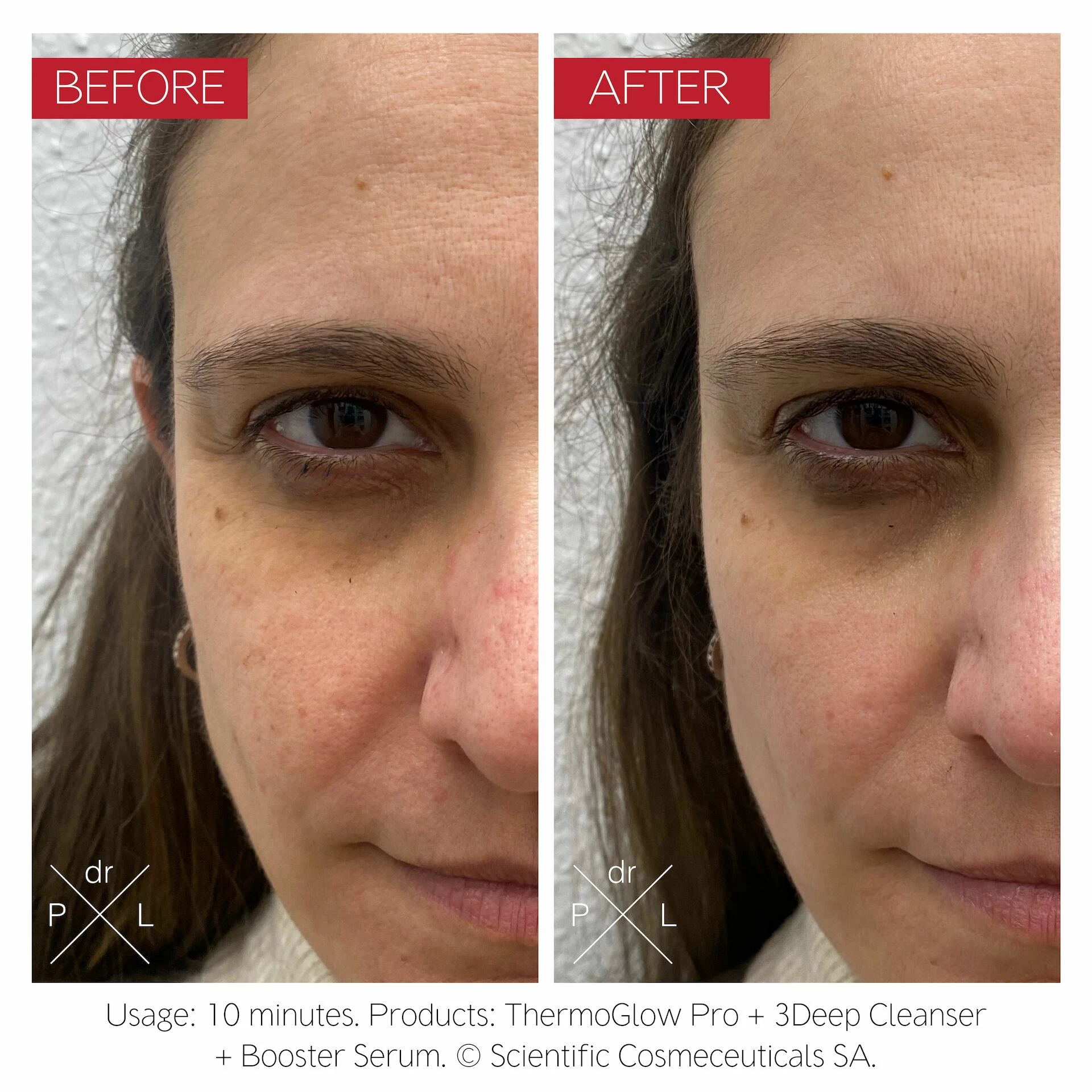 ThermoGlow Pro - Dr. LEVY Elveția
