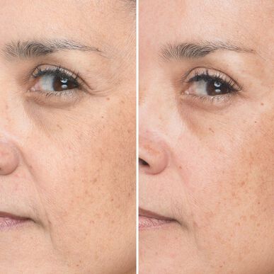 IT Cosmetics Bye Bye Lines koncentruotas serumas odos serumui 30 ml