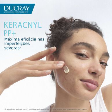 Ducray Keracnyl PP krém proti nedokonalostem pleti, krém proti nedokonalostem a značkám pro pleť se sklonem k akné, 30 ml