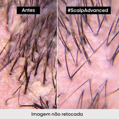 L'Oréal Professionnel Serie Expert Scalp Advanced Pelliculaire Schampo Lugnande torr och fet hårbotten Anti-mjällschampo 500 ml 500 ml