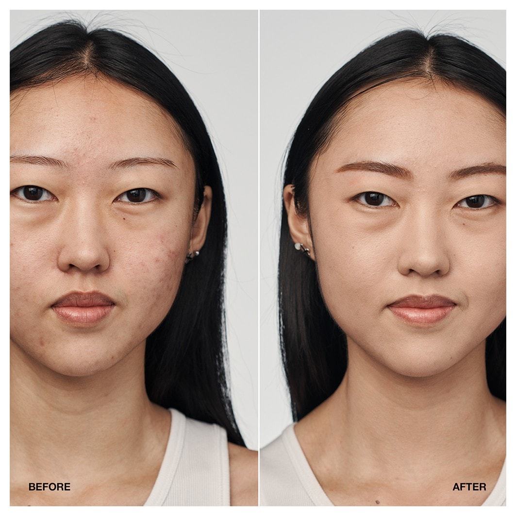 Clinique Foundation Even Better™ klinički serum SPF – 30 ml