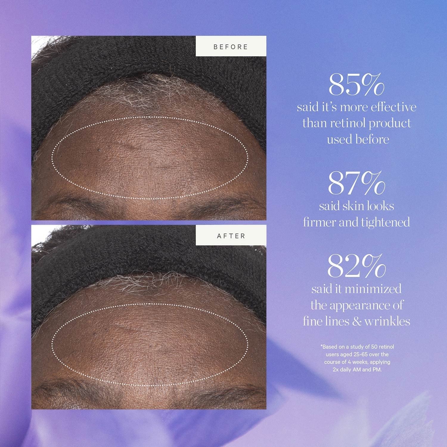 KORA Organics krema za lice s biljnim matičnim stanicama i alternativom retinola – 15 ml