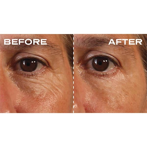 Plump It! Filler dermic fără ace, 15 capsule