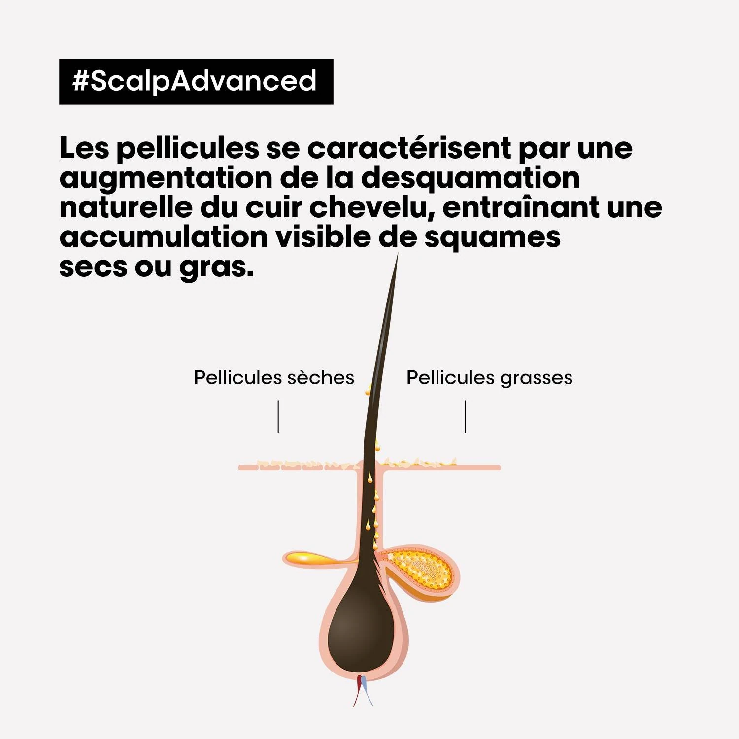L´Oréal Professionnel Paris Clarifiant anti-pelliculaire