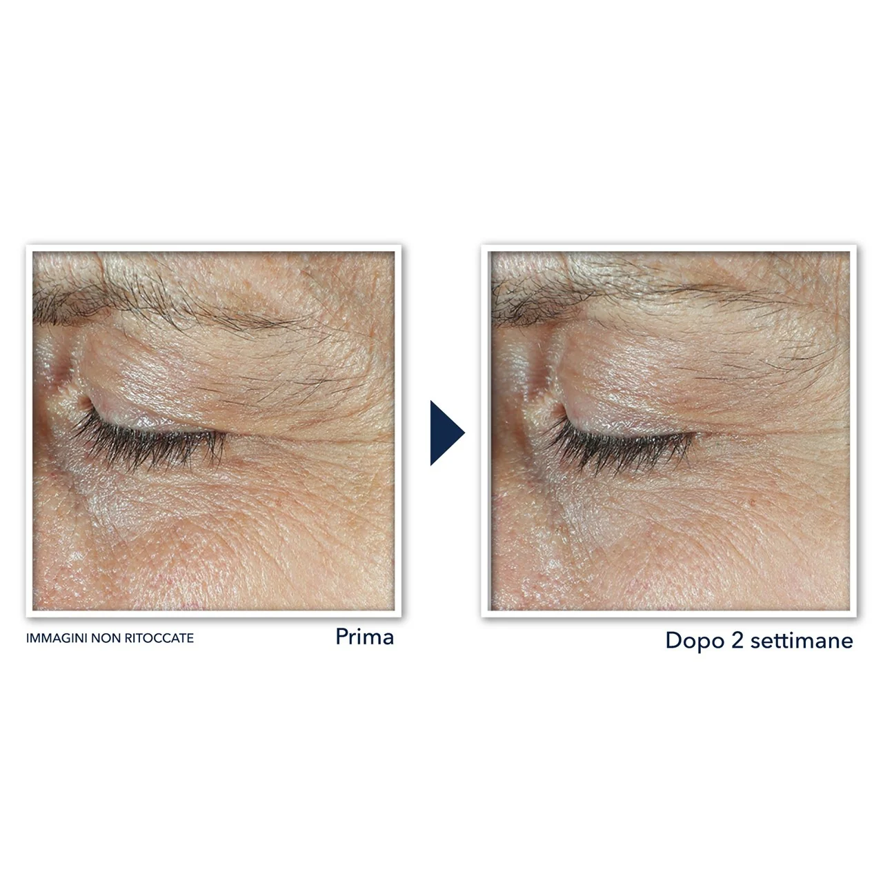 Derm Correxion Crema Contorno Occhi - Contorno occhi antirughe