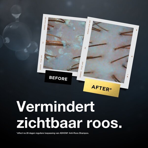 Adhom Antiroossampole<br>300ml