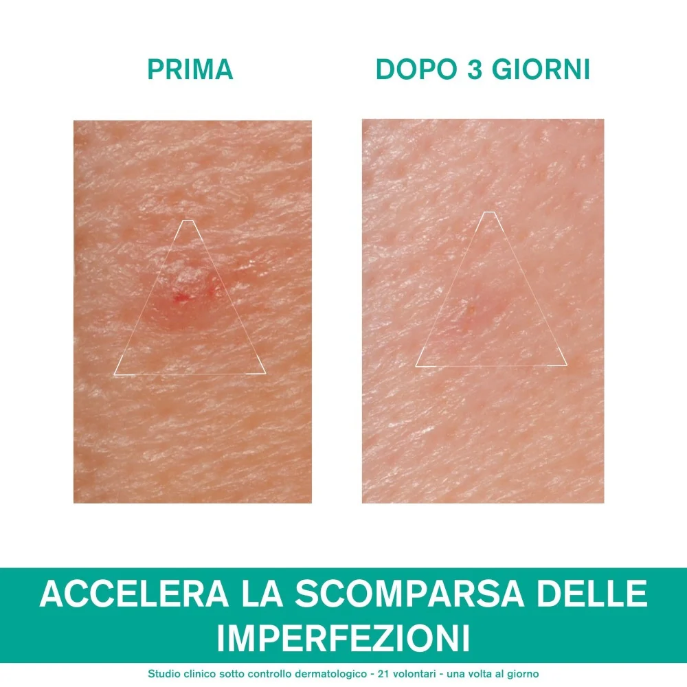HYSÉAC Pasta SOS - Tratt. viso notte antimperfezioni