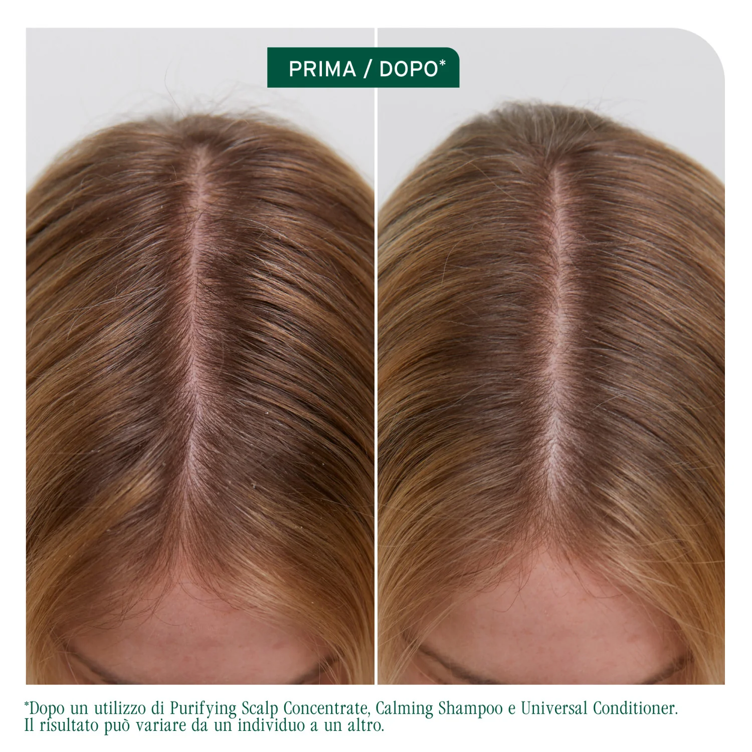 Scalp Sync Clarifying Shampoo - Shampoo Purificante