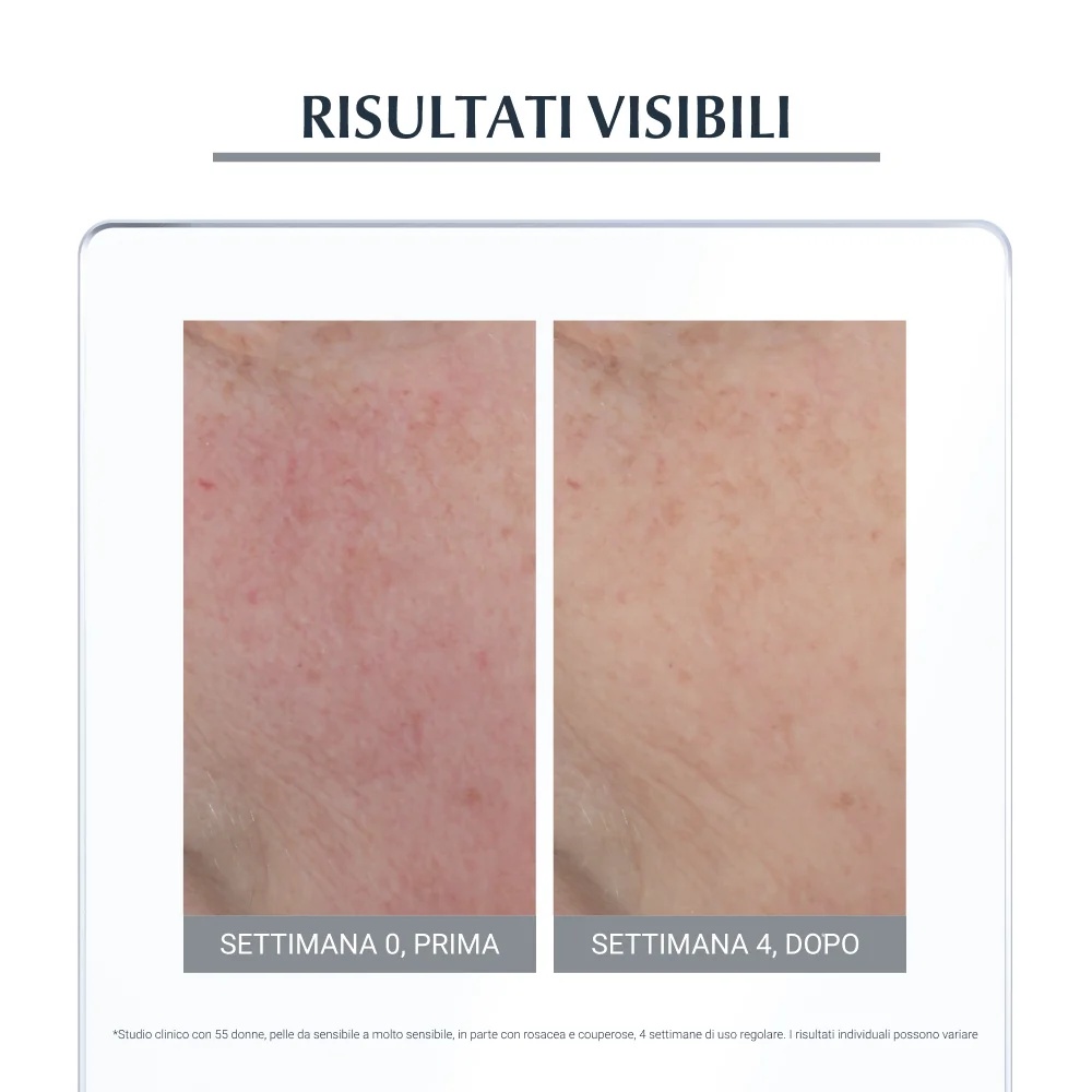 EUCERIN Eucerin dnevna krema proti rdečici SPF 25 50 ml nevtralizirajoča nega