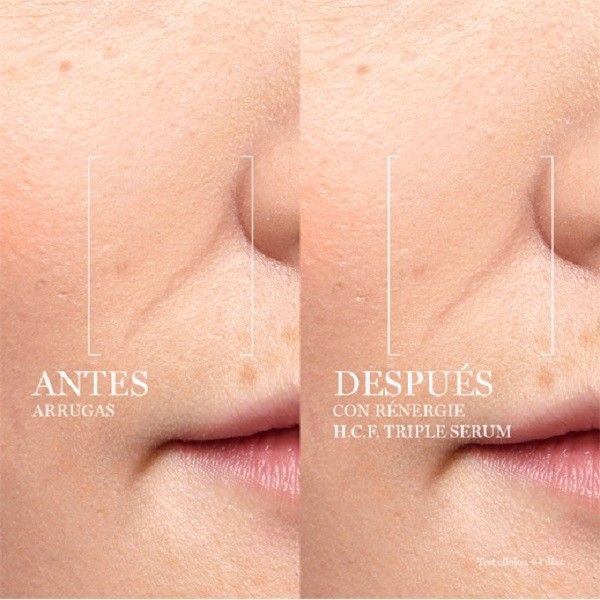 Rénergie HCF троструки серум Луксузни серум против бора и старења