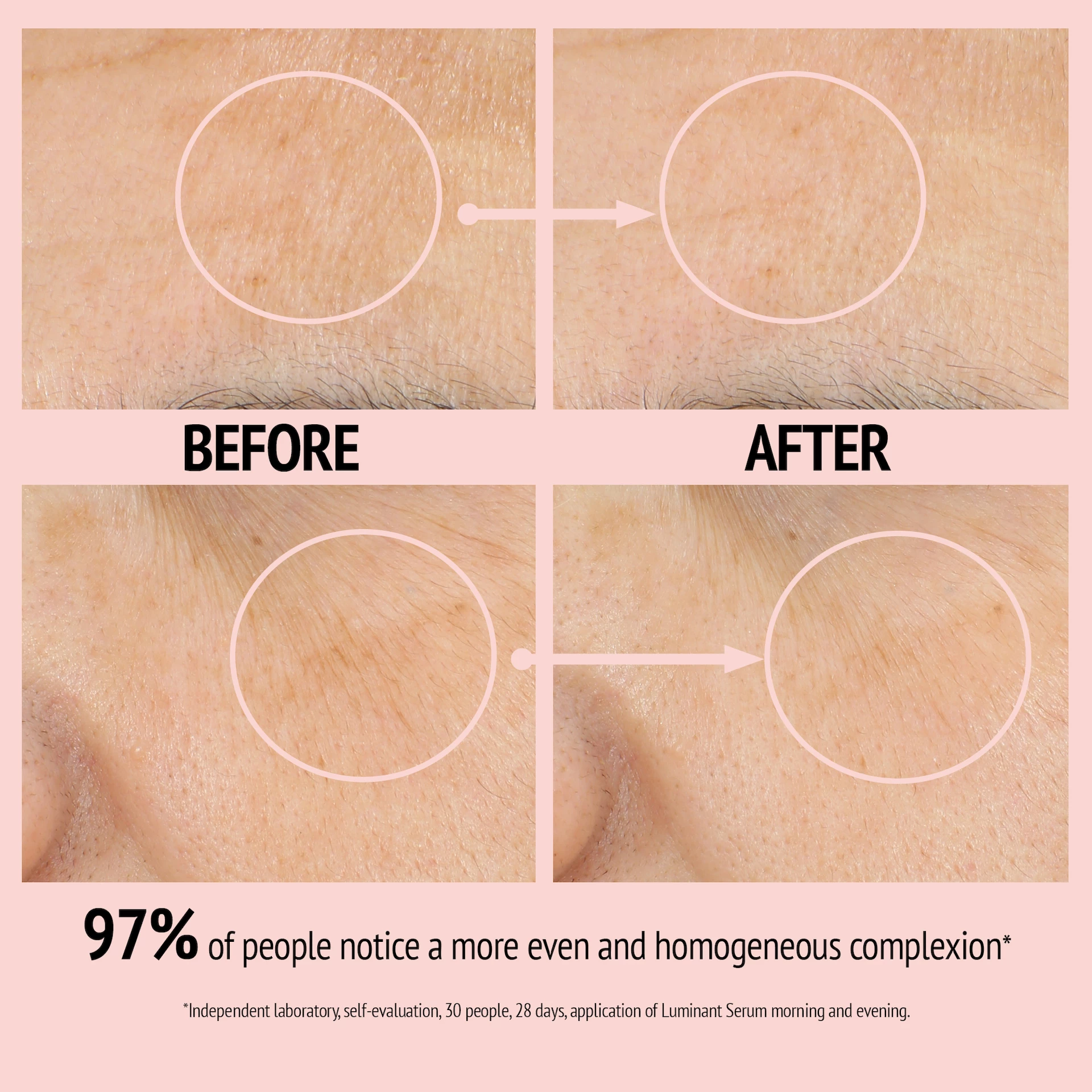 Luminant sötét foltokra korrigáló szérum 30 ml - Comfort Zone