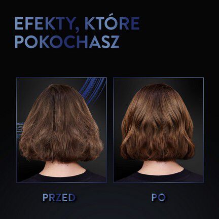 Syoss nuo pleiskanų