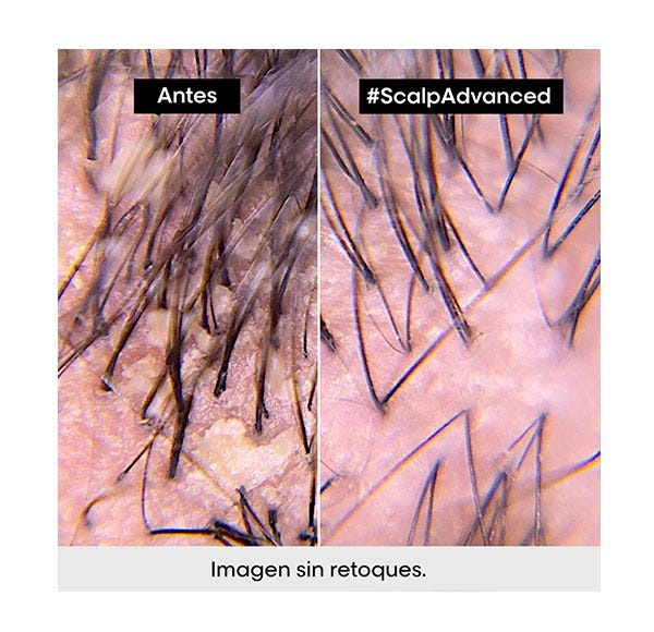 Напредна формула за кожу главе | 300 мл