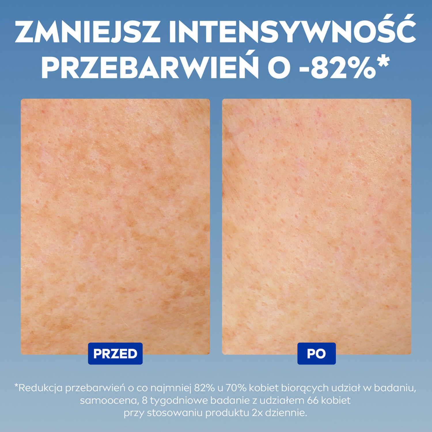 Nivea LUMINOUS630®
