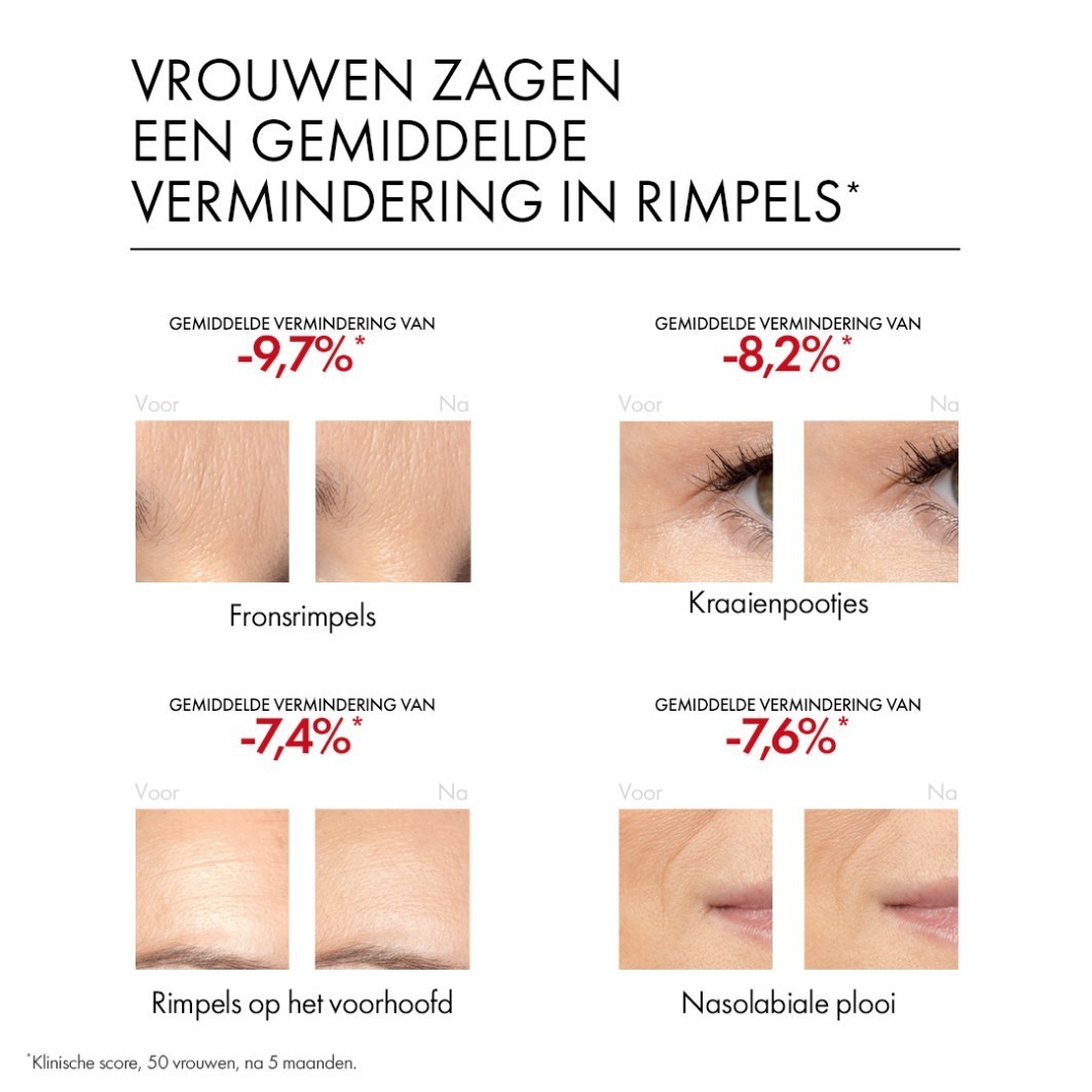 „Vichy“ senėjimą stabdantis serumas „Liftactiv Retinol Specialist“ serumas nuo gilių raukšlių, 30 ml