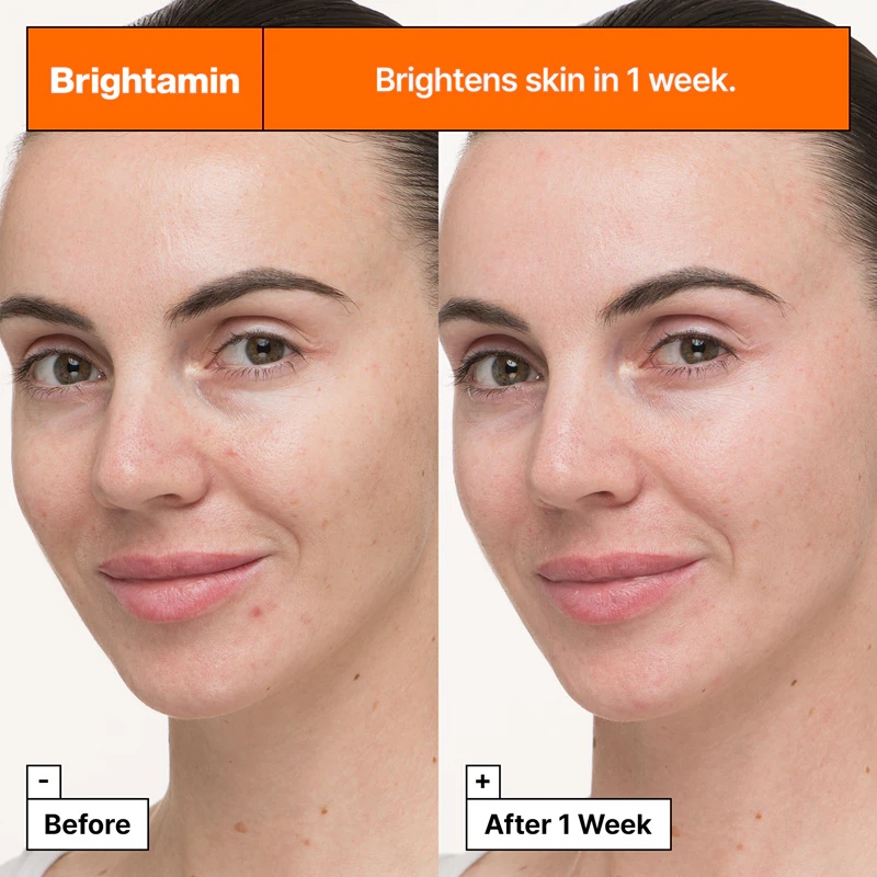 Dr. Jart+ Brightamin Brightening Serum Ampoule – aktyvus skaistinamasis ir lyginamasis serumas su vitaminu C