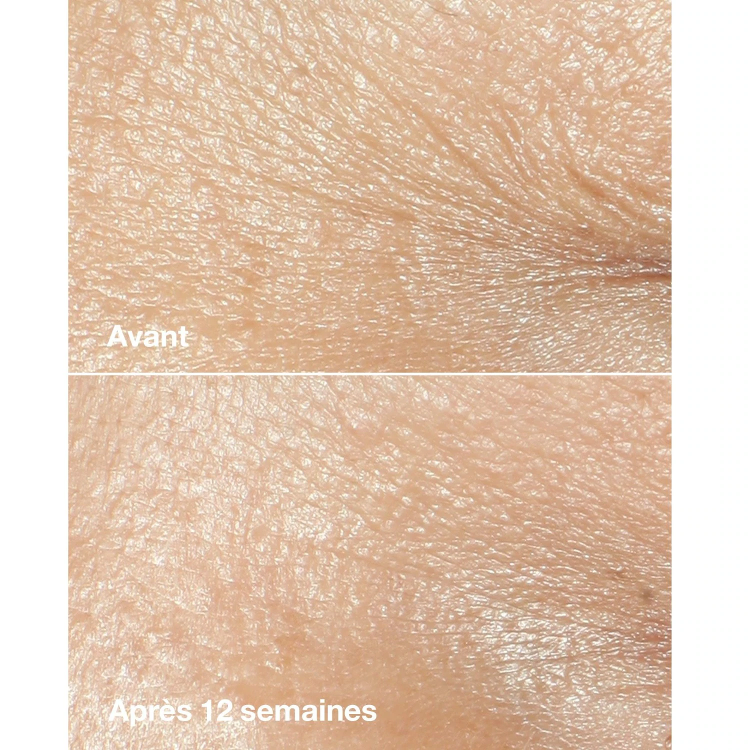 Clinique Crème Correctrice Anti-rides