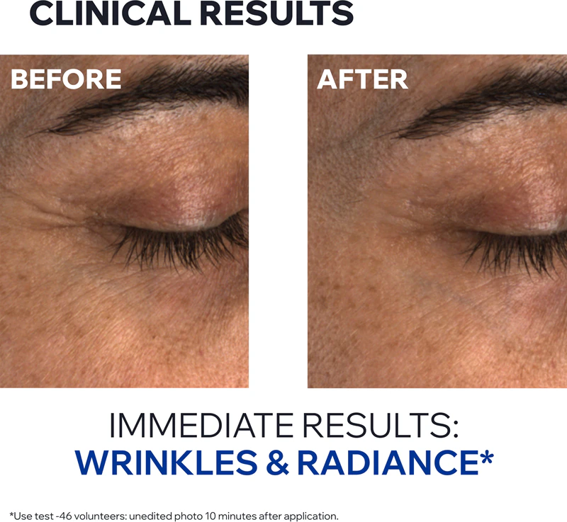 Uriage Age Absolu Blur-redensifying Eye Balm krém proti vráskám pro oční okolí
