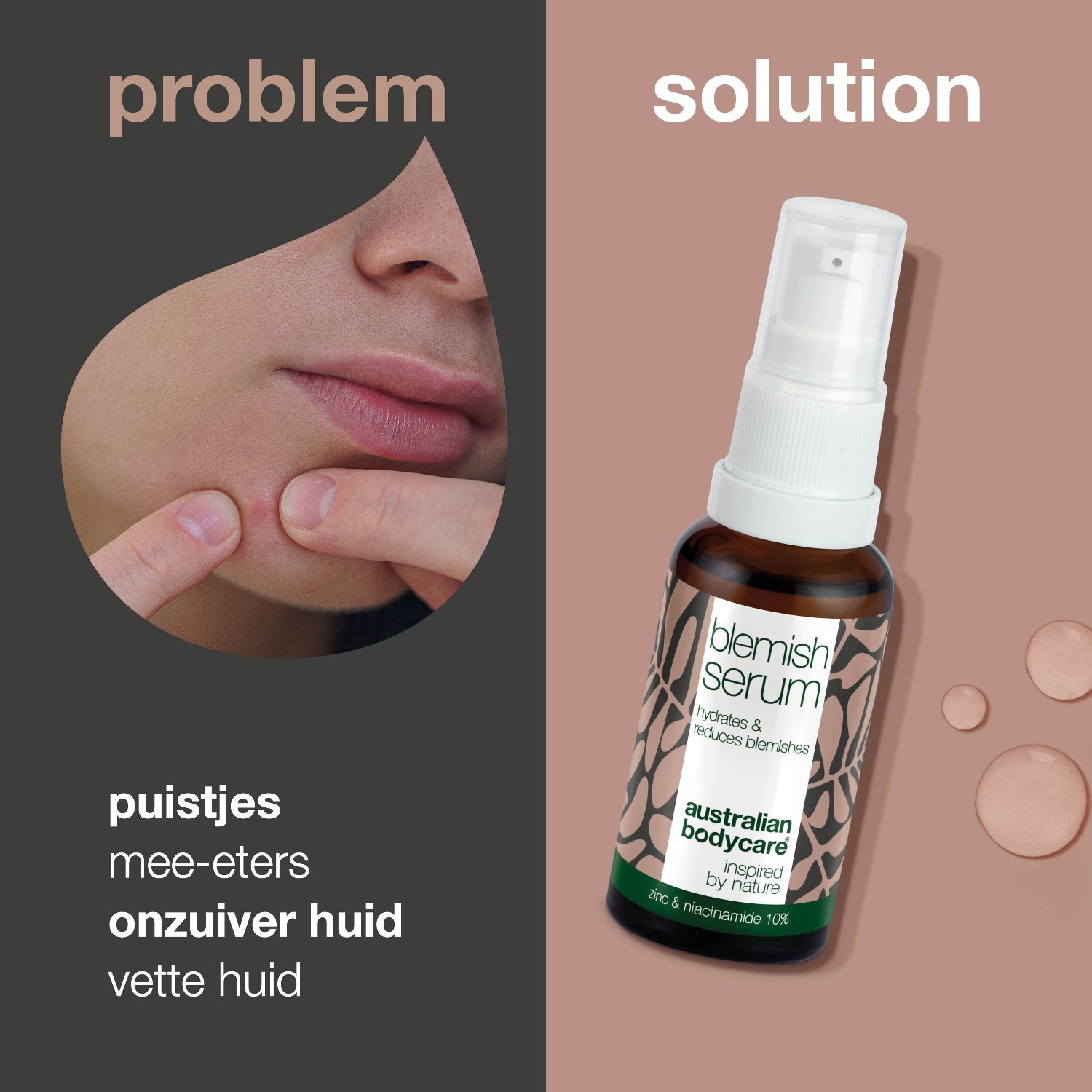 „Australian Bodycare“ drėkinamasis serumas nuo spuogų – 30 ml