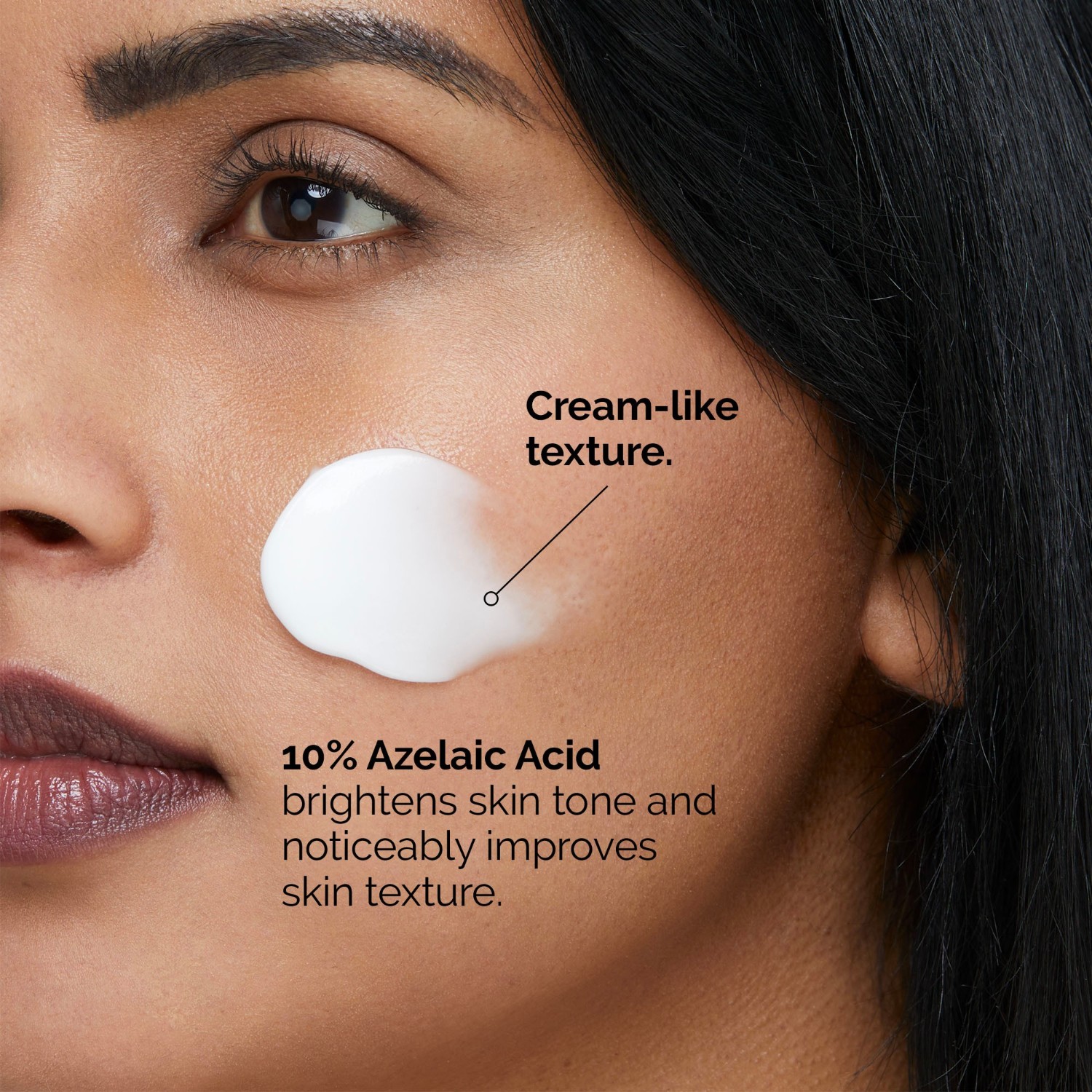 The Ordinary Suspension d’Acide Azélaïque 10%