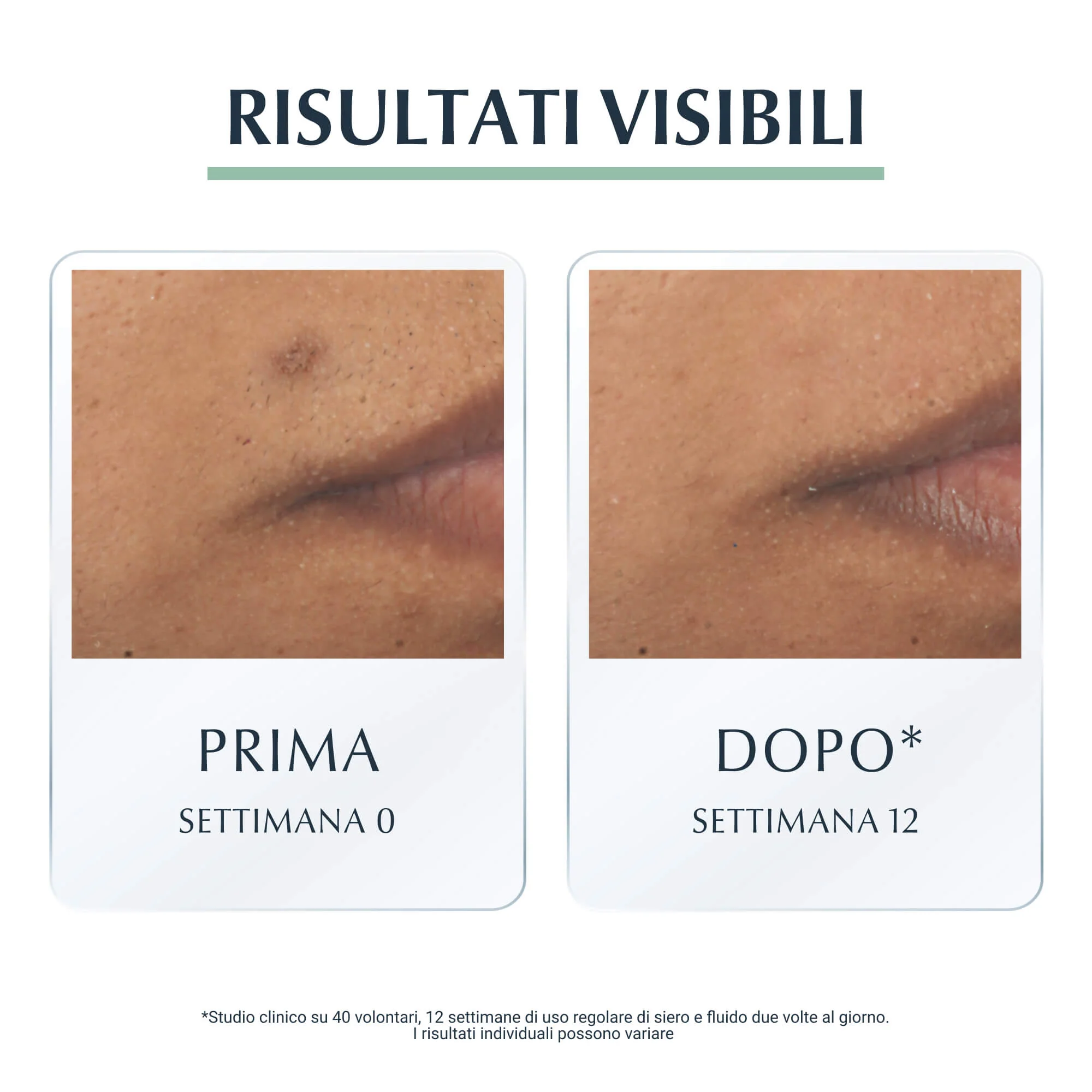 DermoPurifyer Oil Control Siero Tripla Azione - Siero viso effetto globale