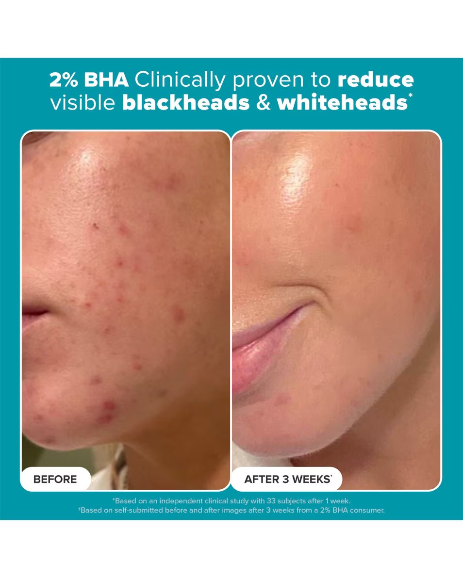 Paula's Choice SKIN PERFECTING Υγρό Απολεπιστικό με 2% BHA