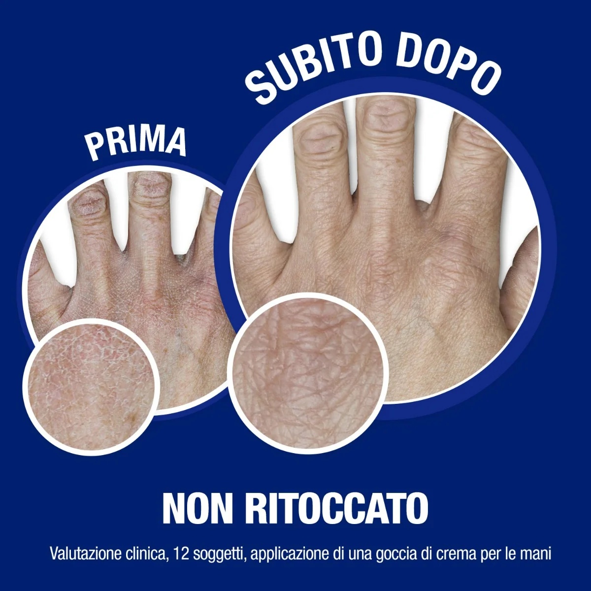 NEUTROGENA Neutrogena Norwegian Formula hand- en nagelcrème 75 ml hydrateert intensief