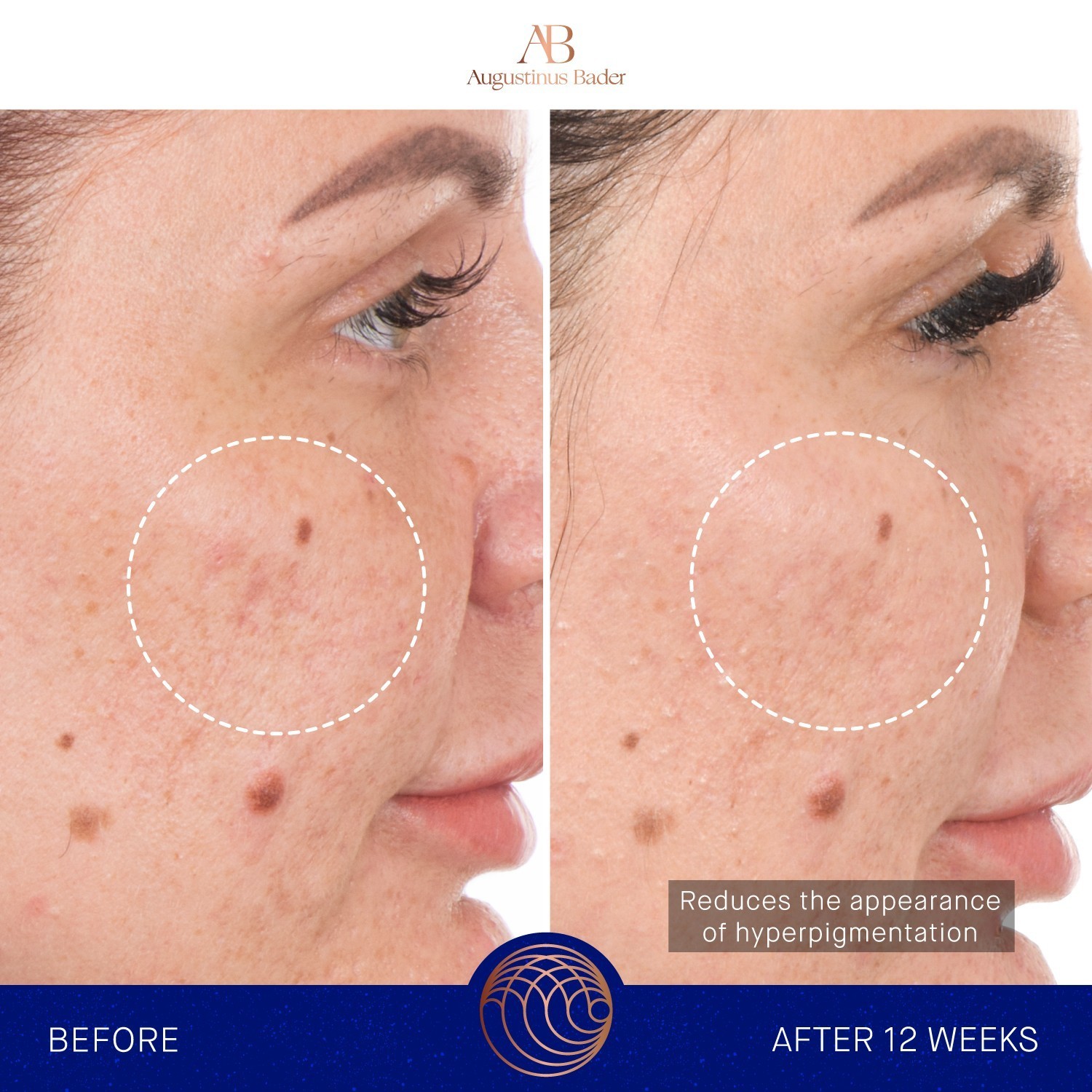 Augustinus Bader drėkinamasis serumas RETINOL SERUM - 30 ml